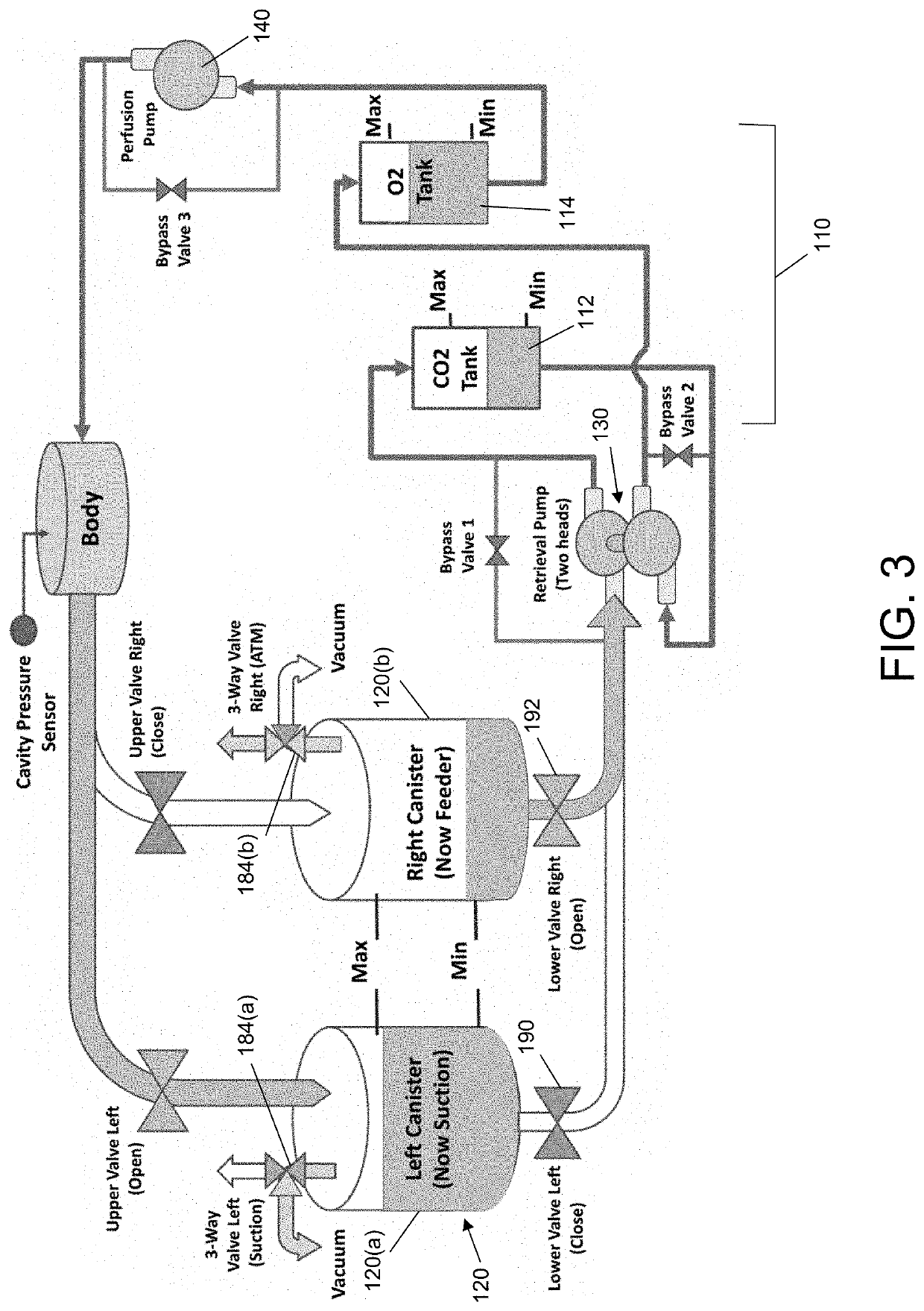 Peritoneal oxygenation system and method