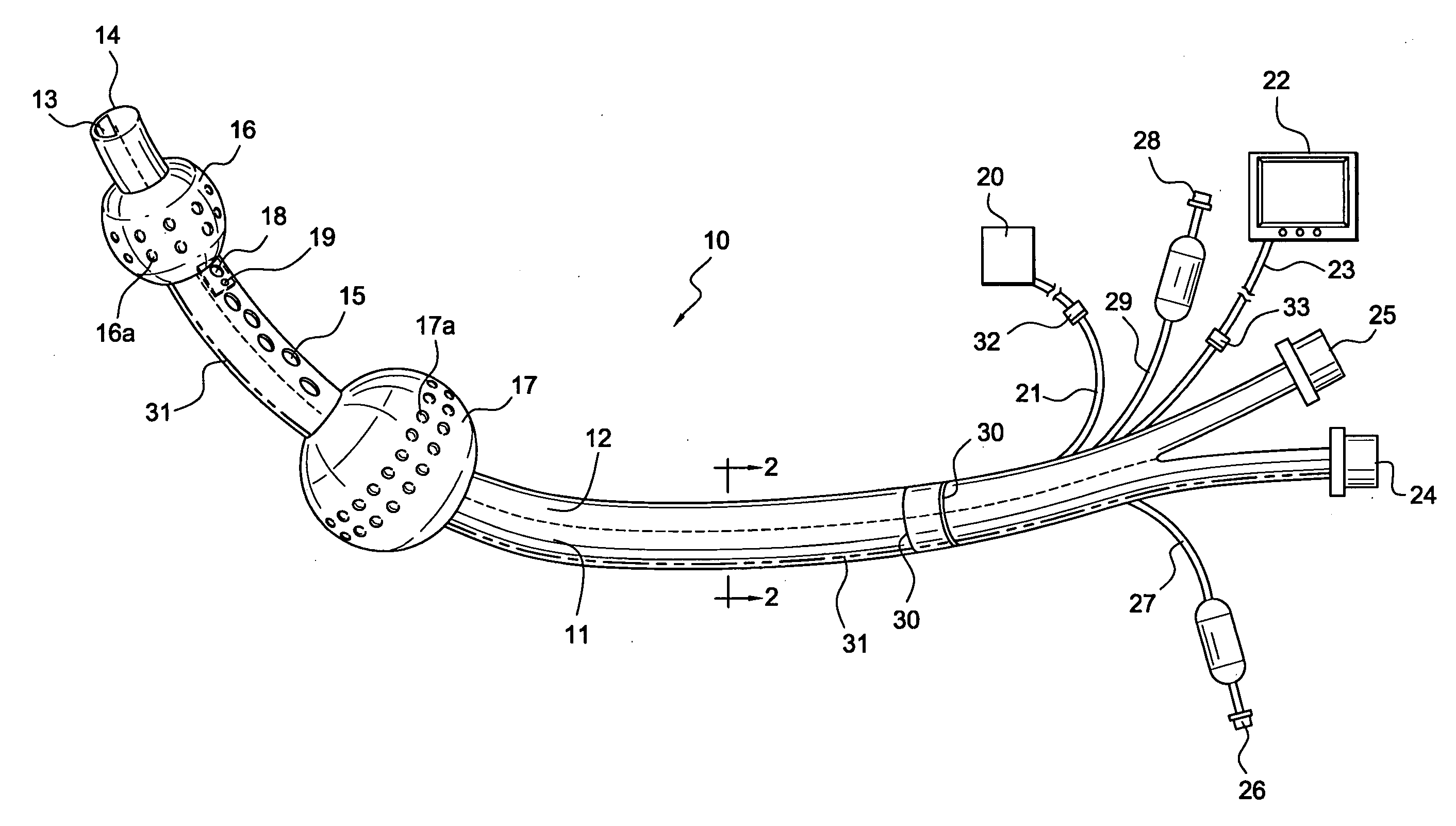 Visualization esophageal-tracheal airway apparatus and methods