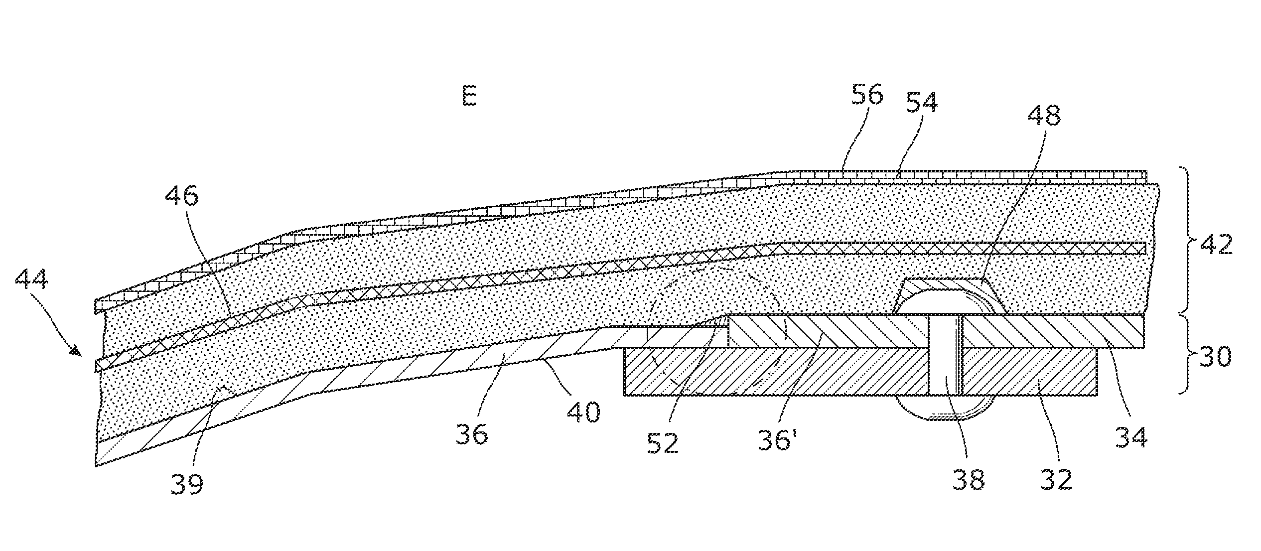 Aircraft fuselage comprising an outer insulation