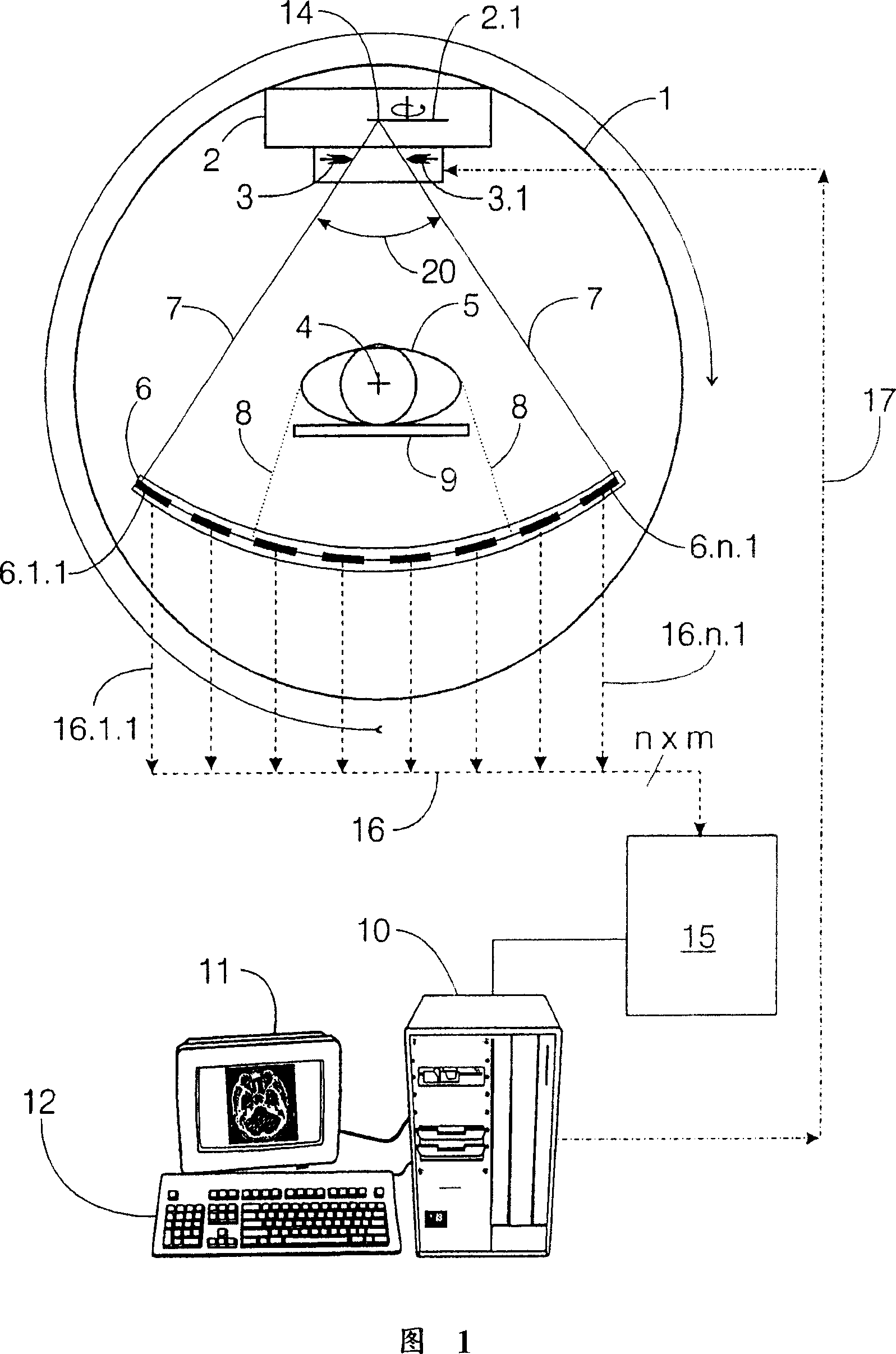 Diaphragm regulating method of computer lamination contrast and computer lamination contrast apparatus