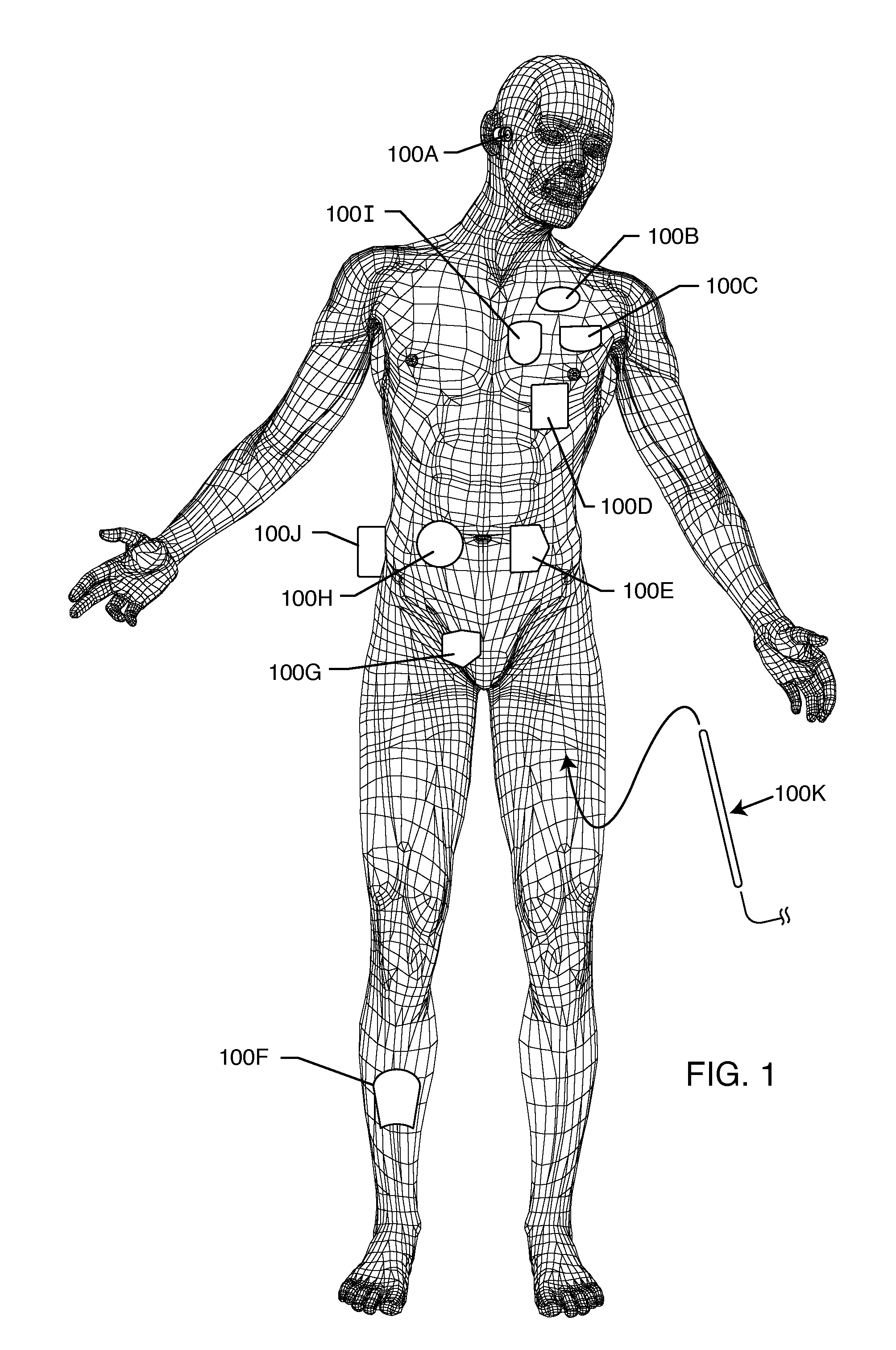 EMI filter employing a capacitor and an inductor tank circuit having optimum component values