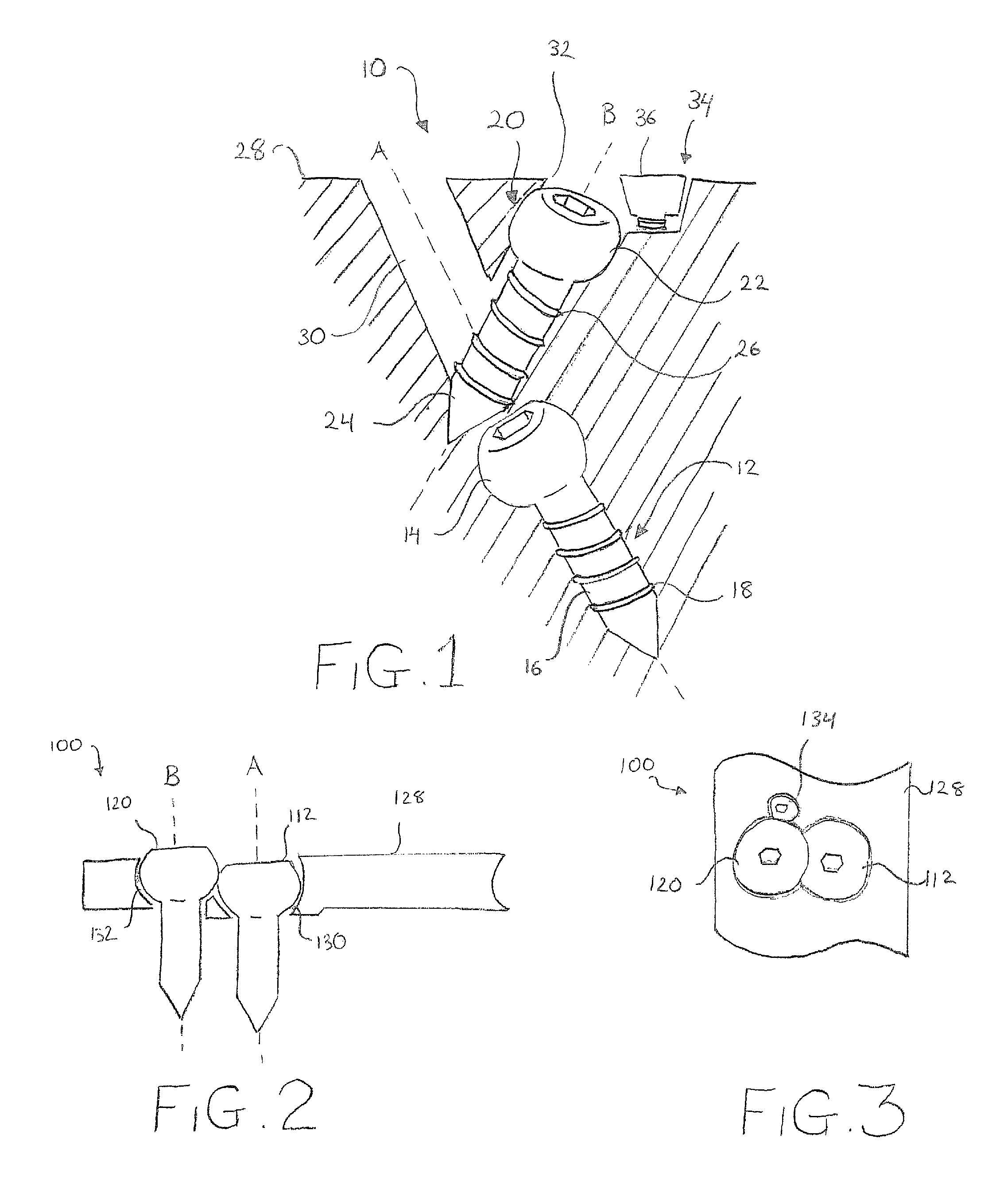 Orthopedic fastener blocking system