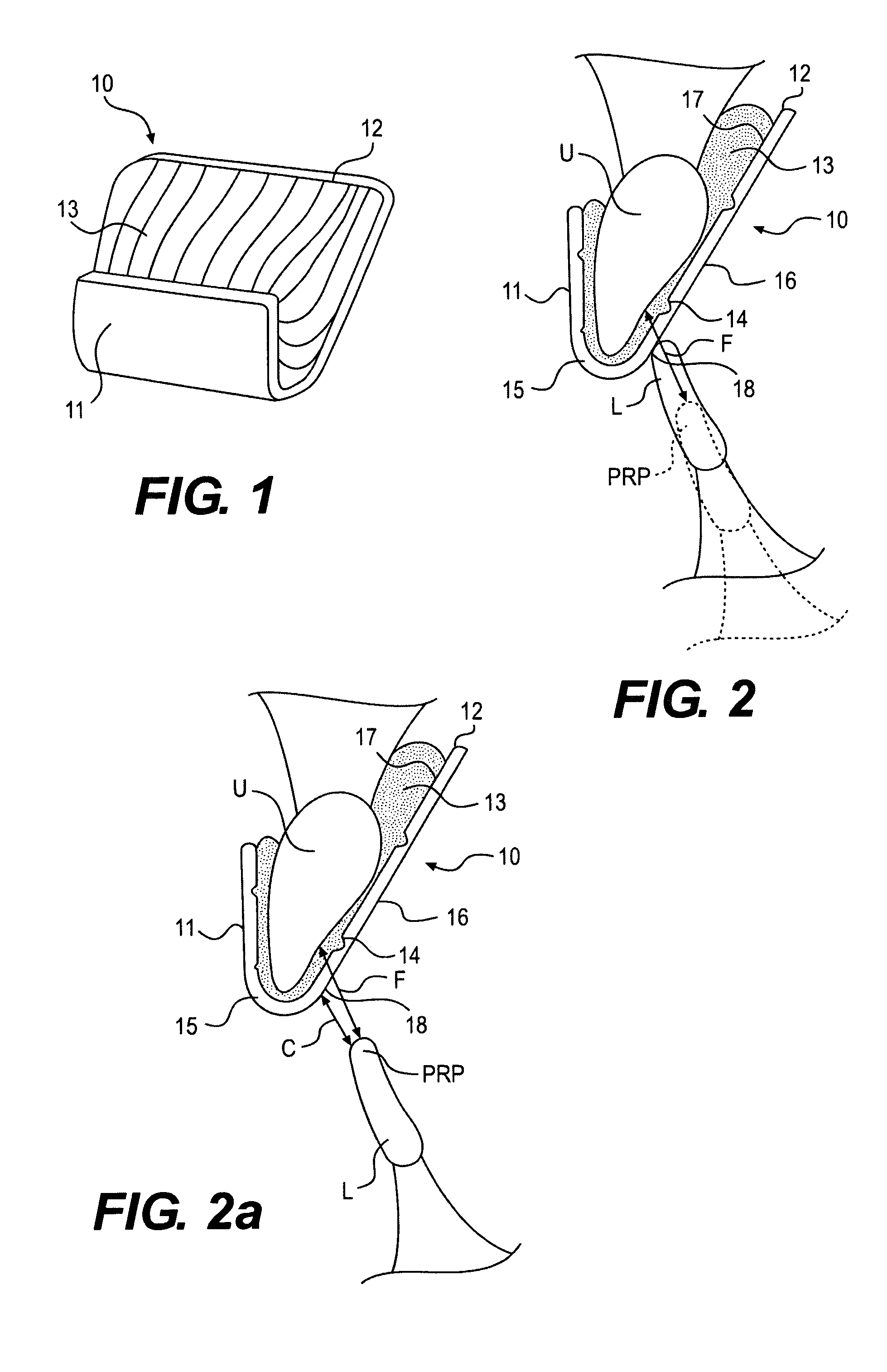 Intra-oral device