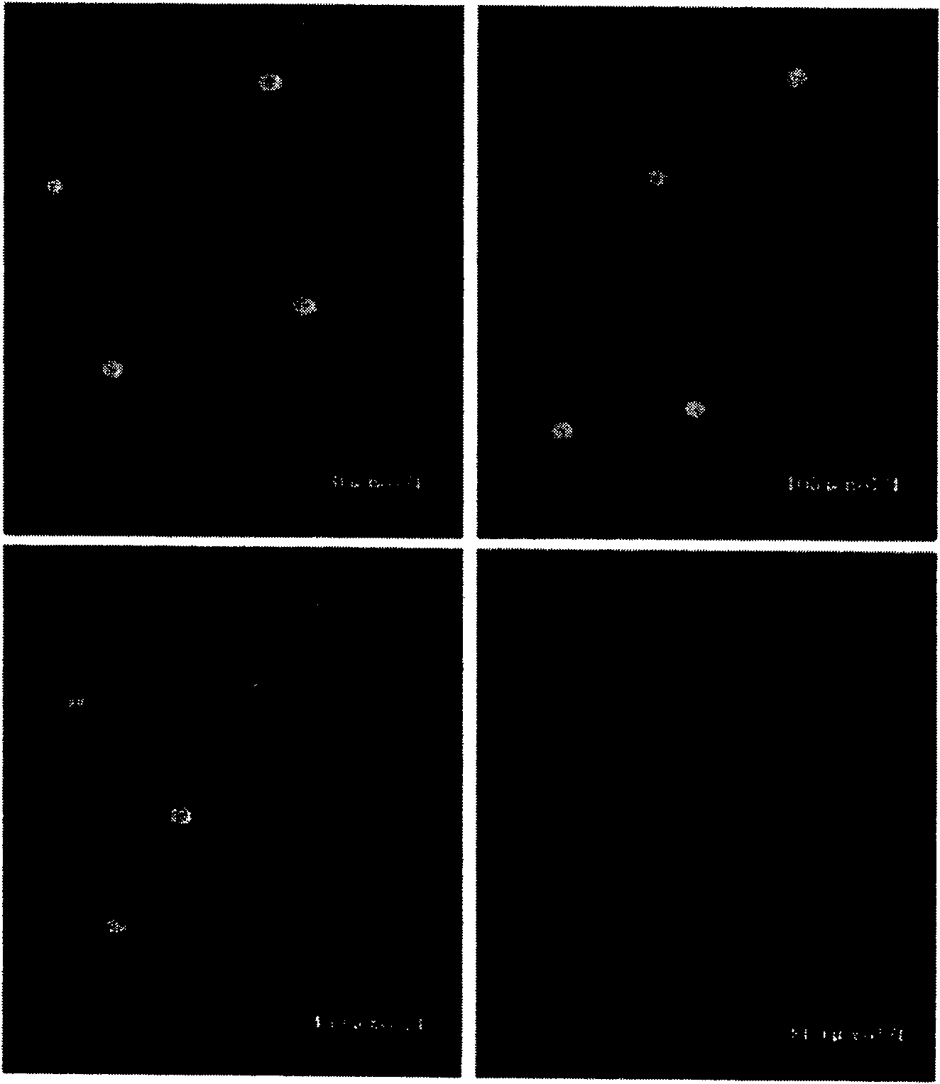 Preparation method of sample used for electrophoresis imaging analysis of single-cell gelatin and reagent kit