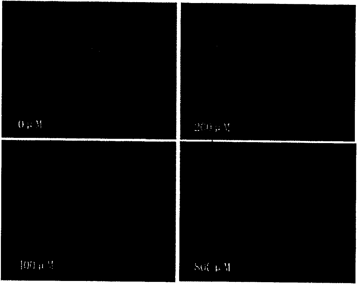 Preparation method of sample used for electrophoresis imaging analysis of single-cell gelatin and reagent kit