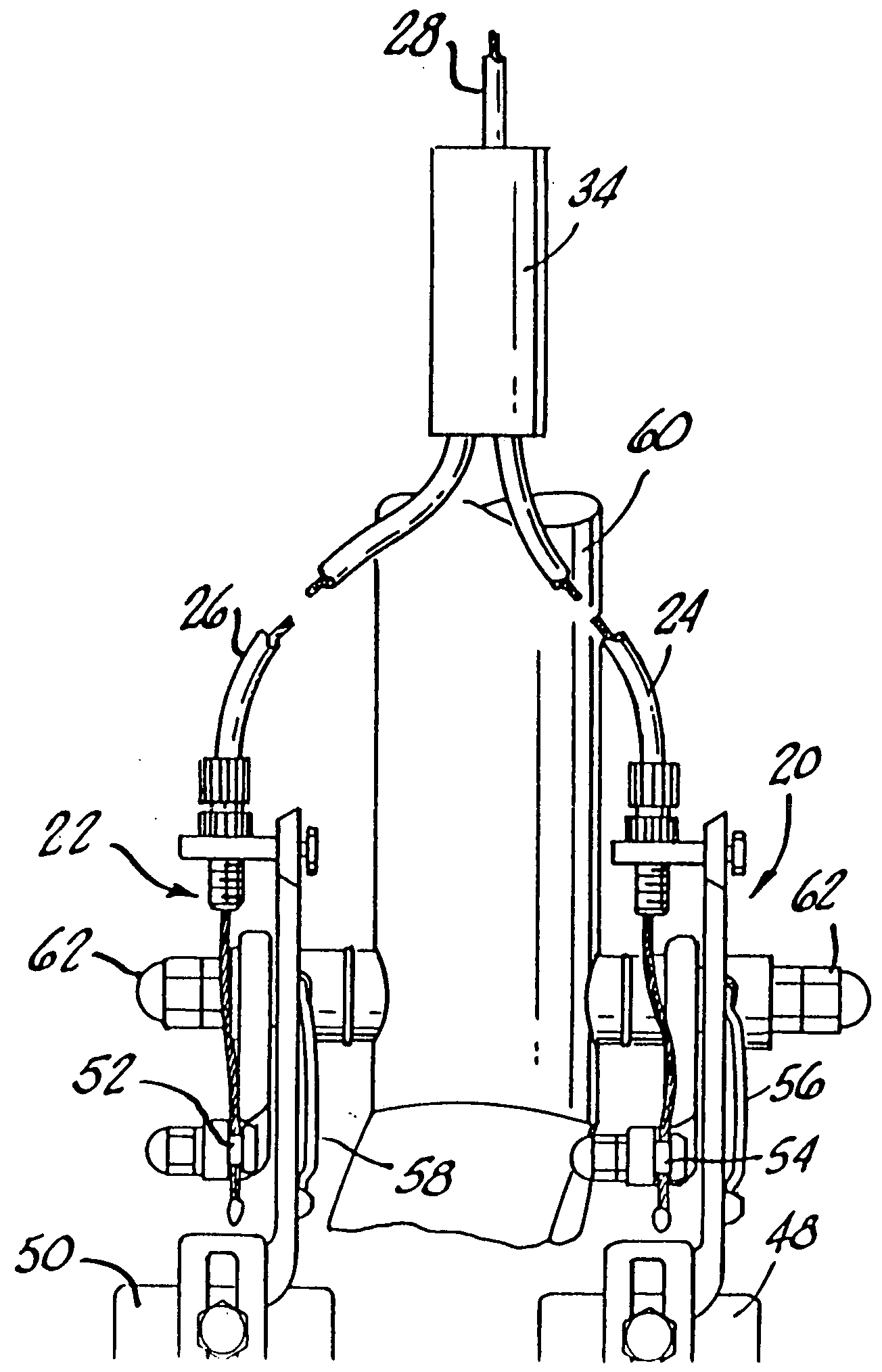 Dual bicycle braking system