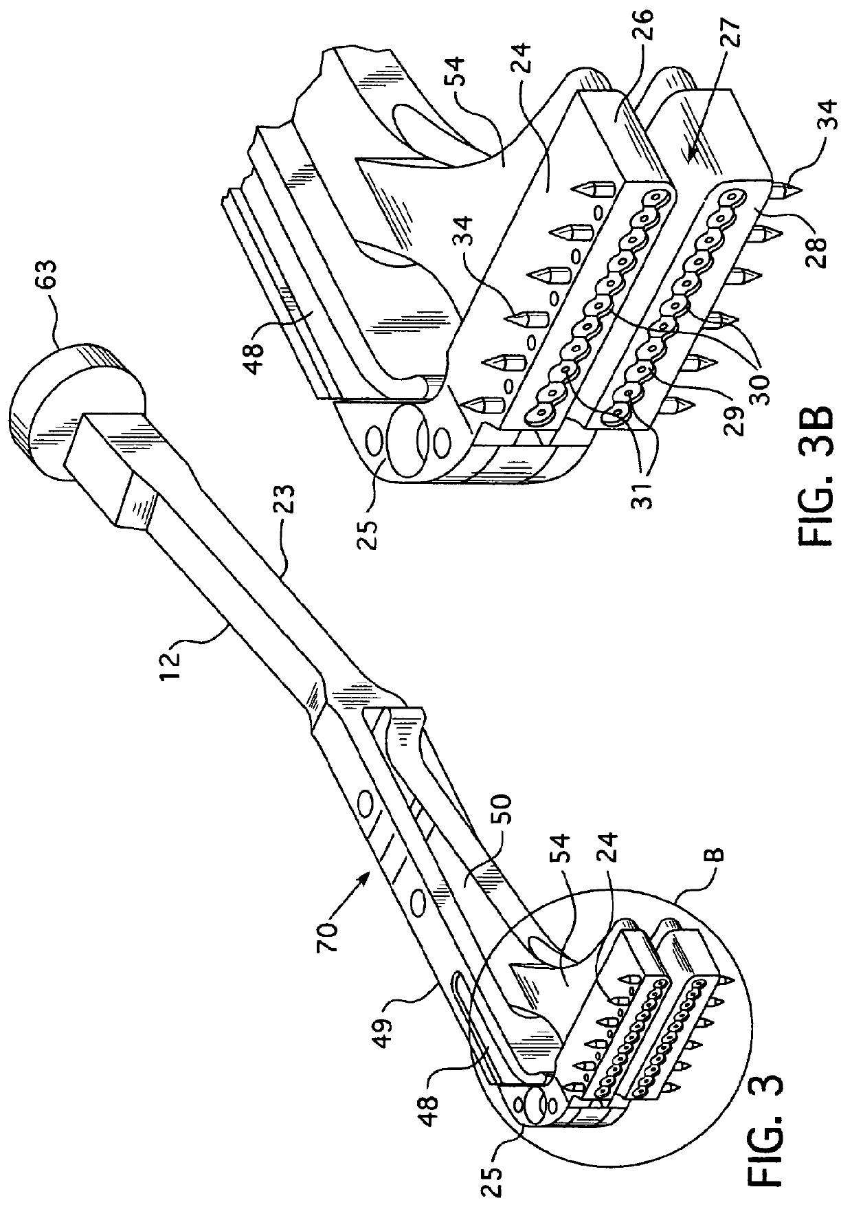 Stapling apparatus for performing anastomosis on hollow organs