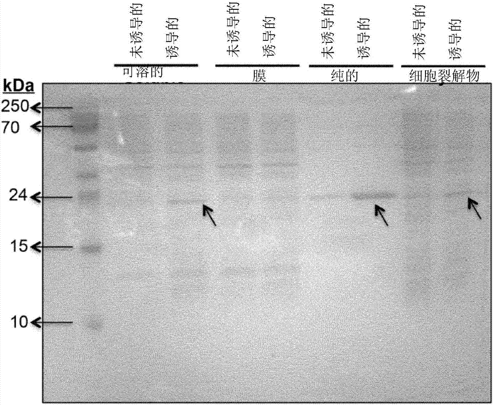 Analytical and diagnostic methods utilizing shigella flexneri apyrase