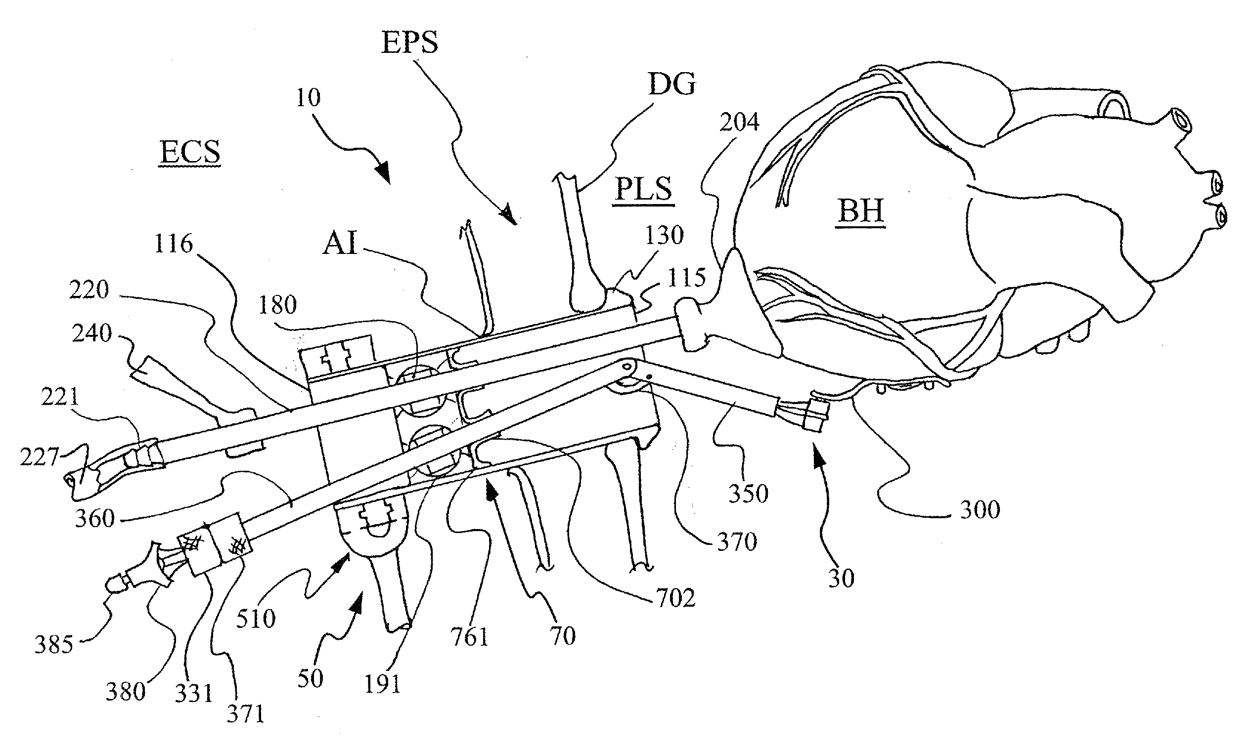 Surgical apparatus and method for performing transabdominal cardiac surgery