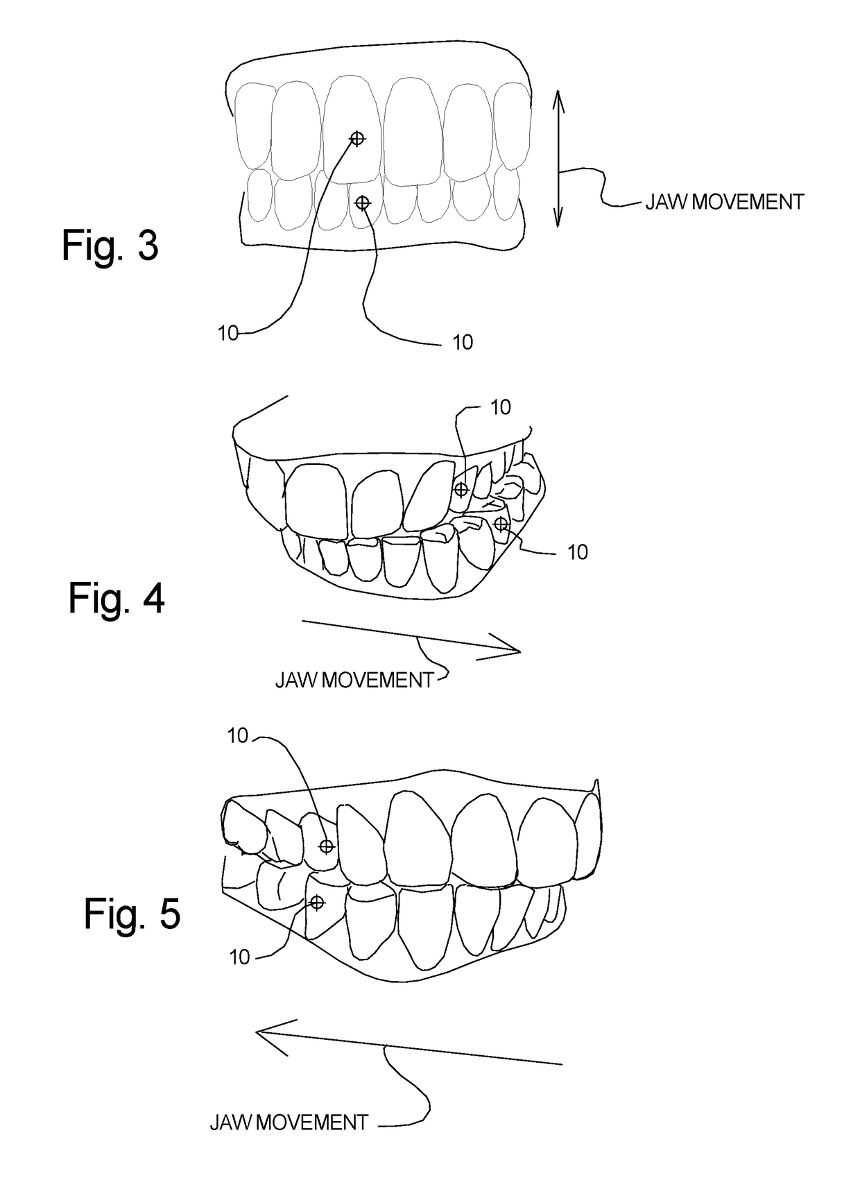 Virtual Dental Articulator And System