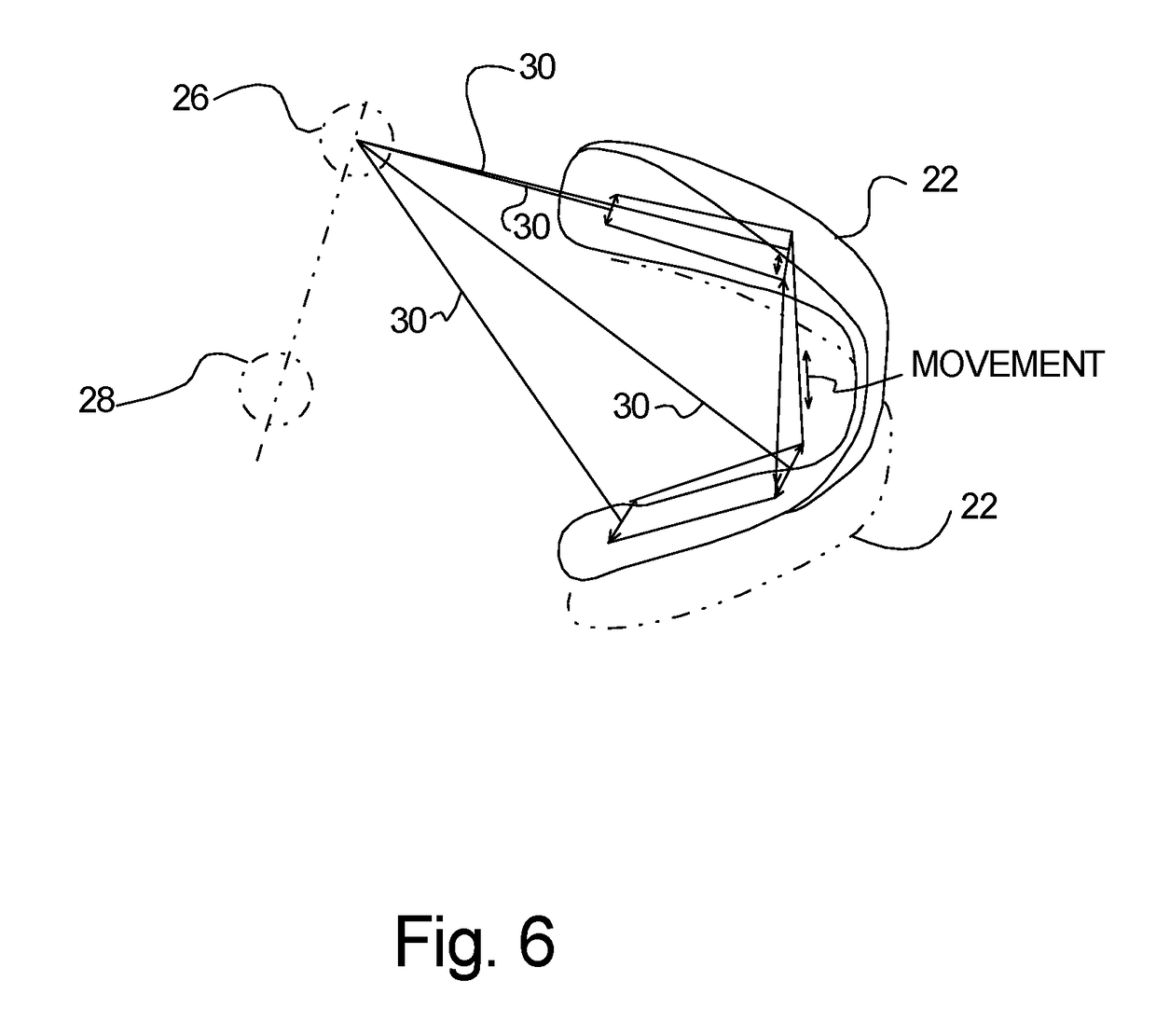 Virtual Dental Articulator And System