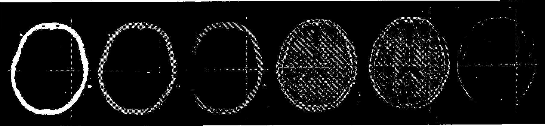 Method for acquiring nerve navigation system imaging data