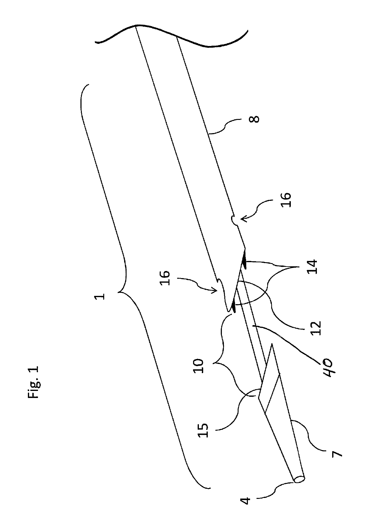 Externally supported anastomosis