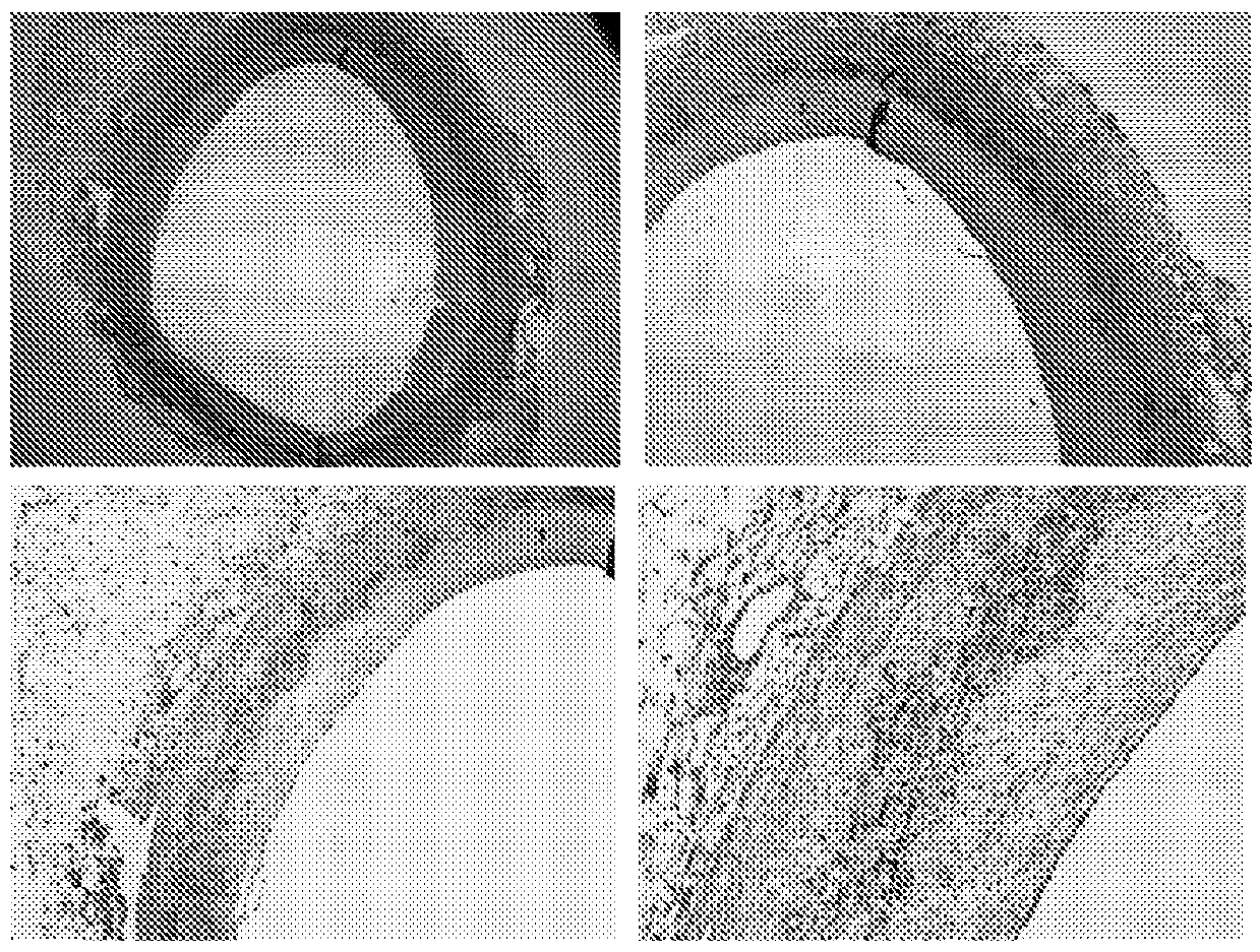 Biochemical marker for CVD risk evaluation