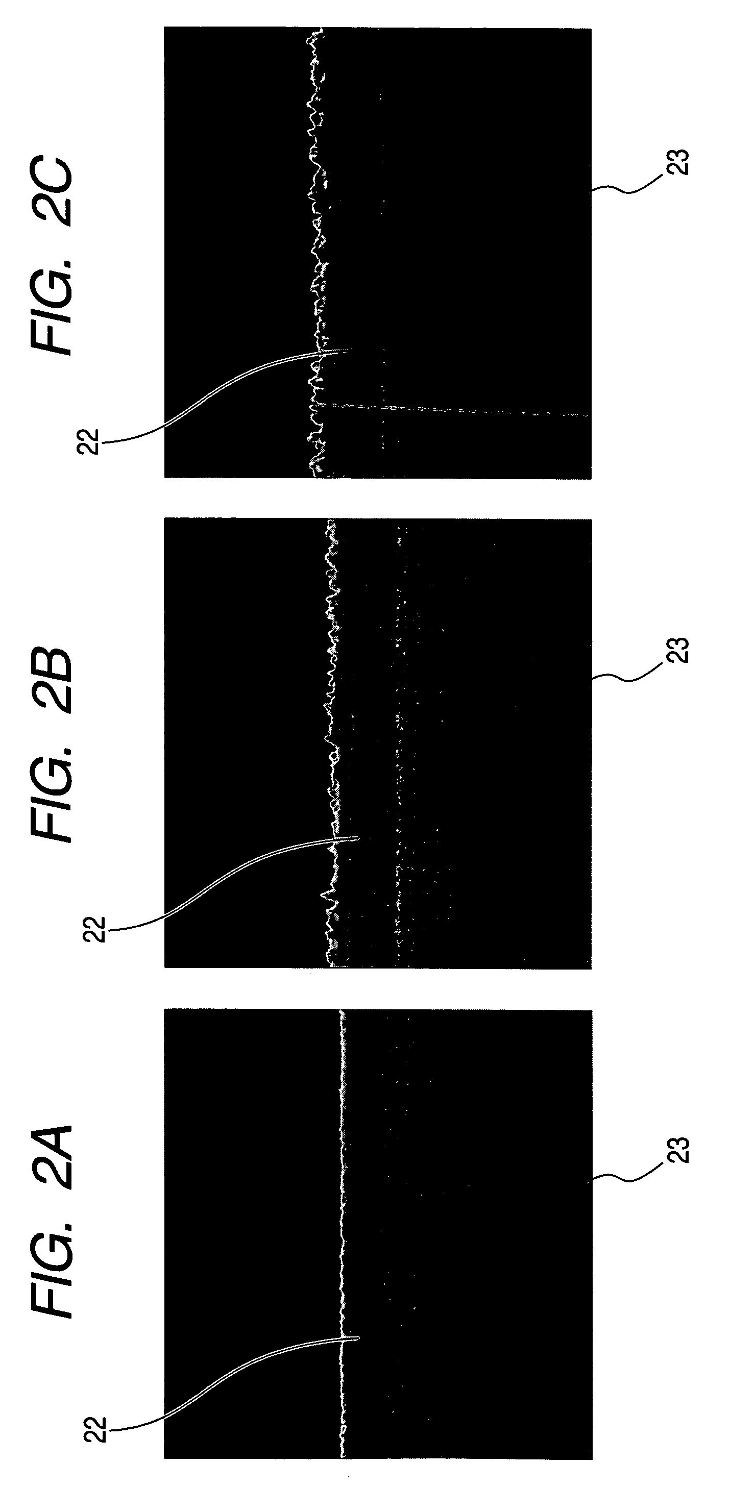 Dry etching method and apparatus