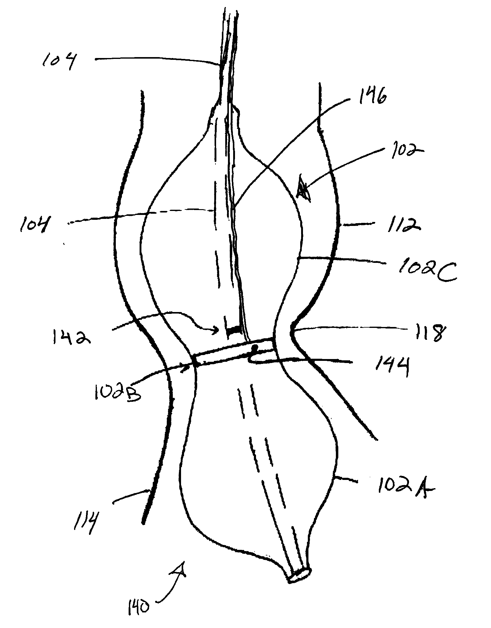 Valvuloplasty Catheter And Methods