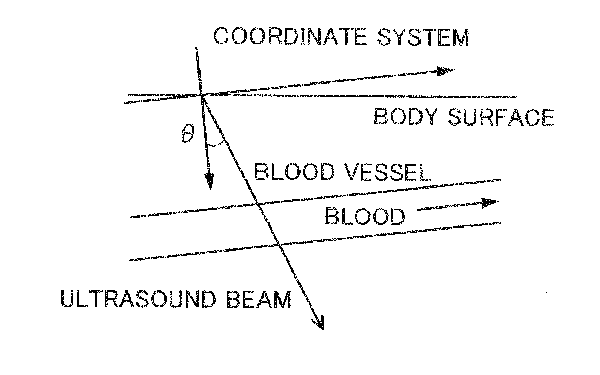 Displacement measurement method and apparatus, and ultrasonic diagnostic apparatus