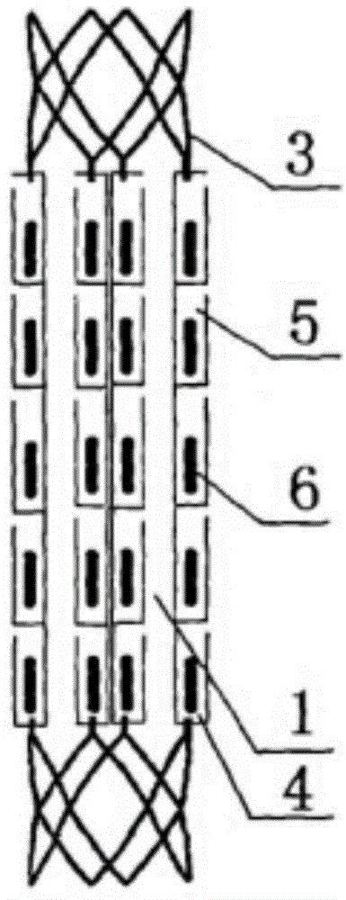 Three-dimensional precise intraluminal radiation therapy method and system for cancer treatment