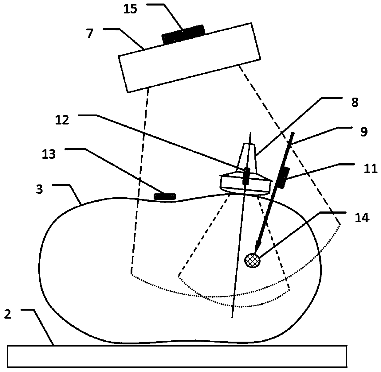 CT and ultrasonic image fused minimally invasive intervention guiding system and method