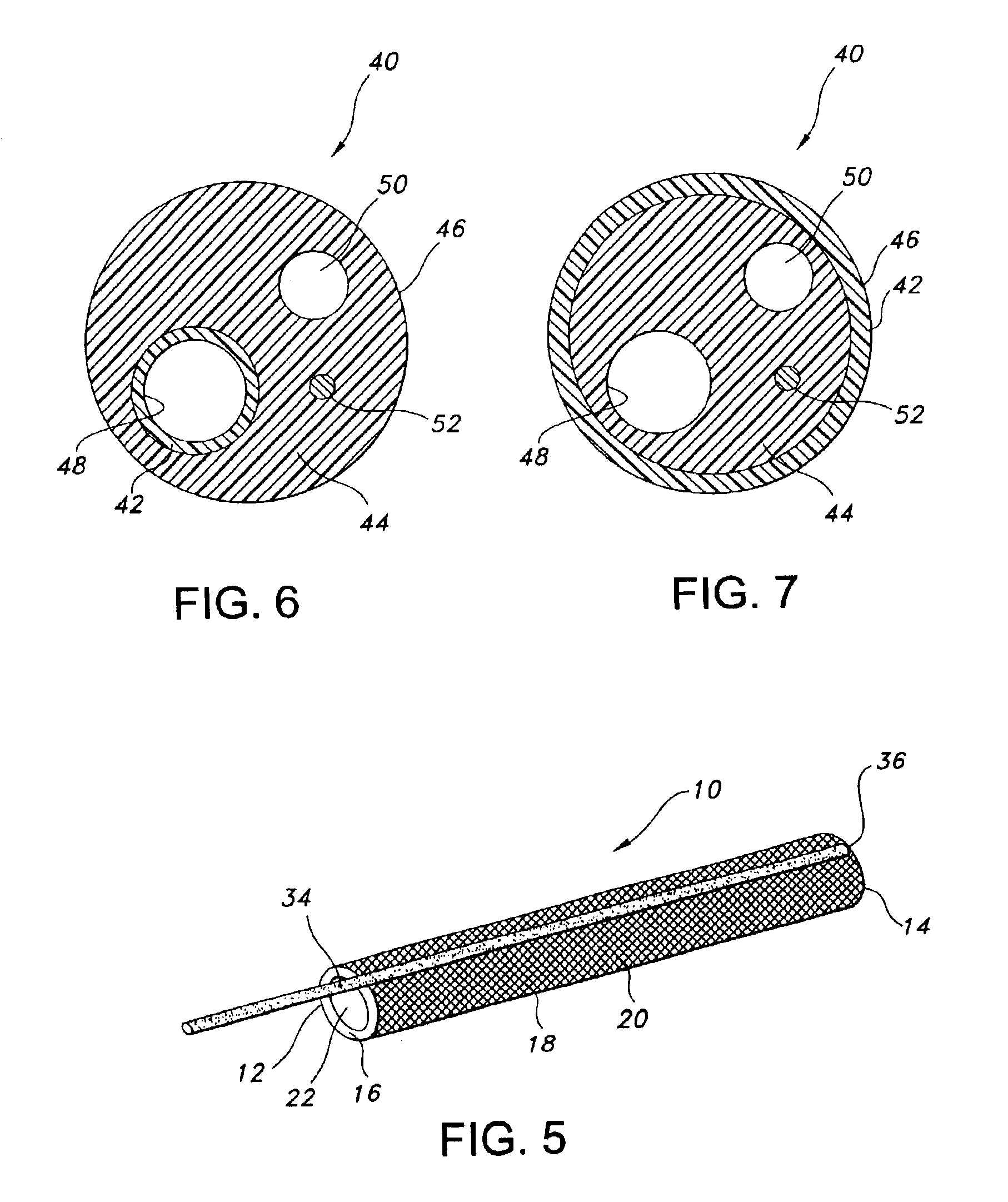 Intraluminally placeable textile catheter, drain and stent