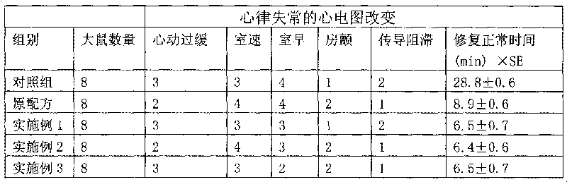 Metoprolol tartrate injection and preparation method thereof