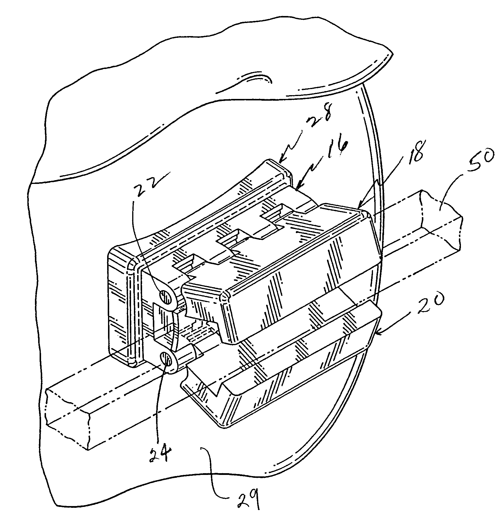 Self-ligating orthodontic appliance