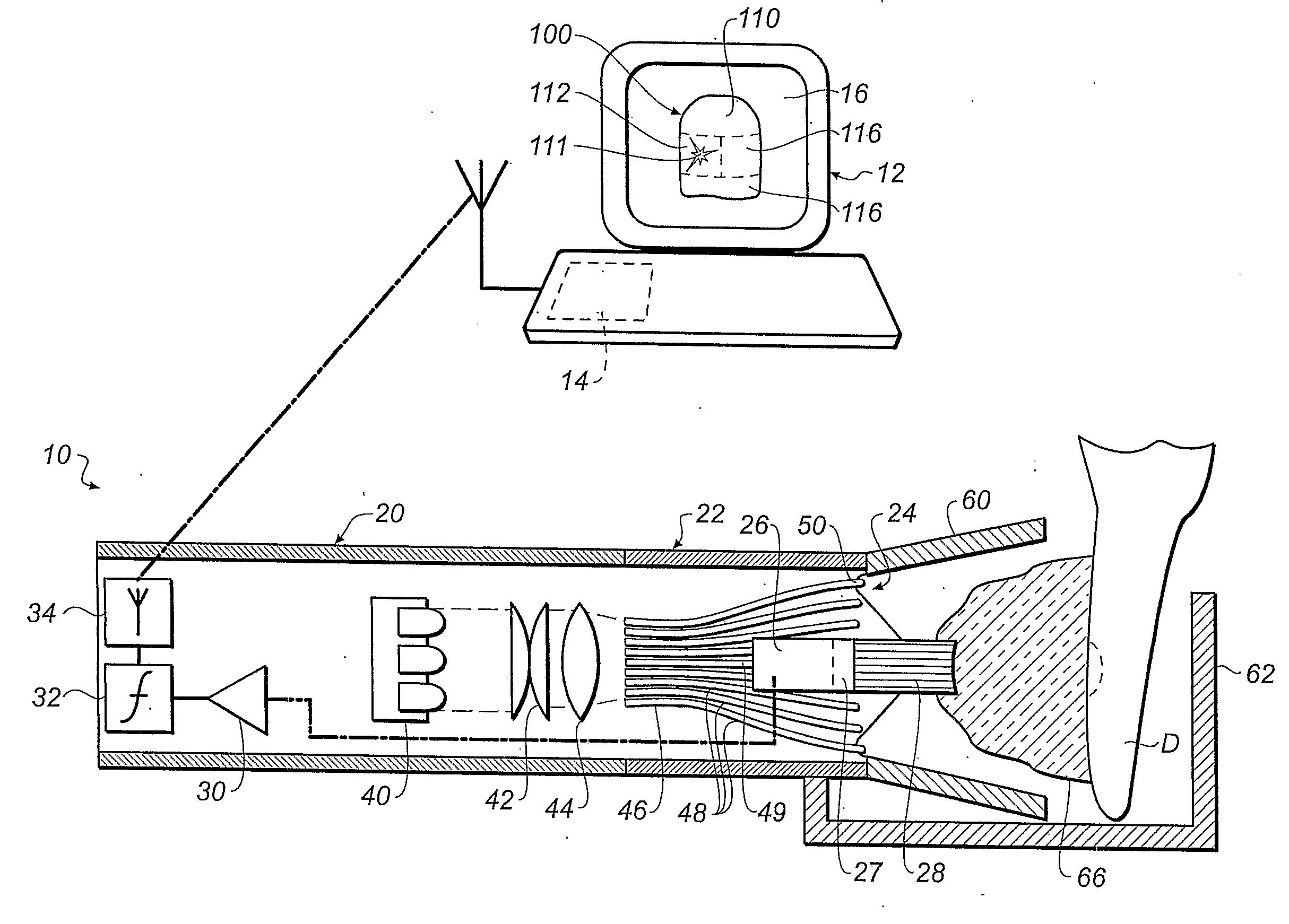 Equipment and method for measuring dental shade