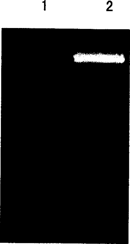 Gene engineering preparation method of human pancreas secreted trypsin inhibitor