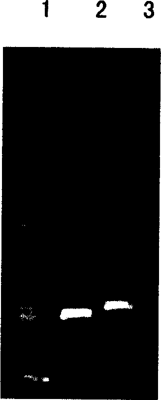 Gene engineering preparation method of human pancreas secreted trypsin inhibitor