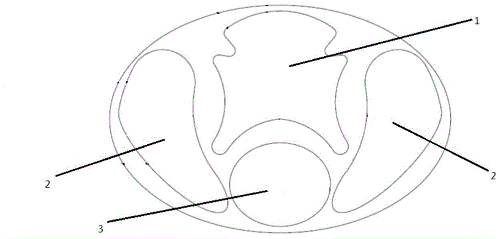 Spinal cord micro-catheter stent fast to form and manufacturing method thereof