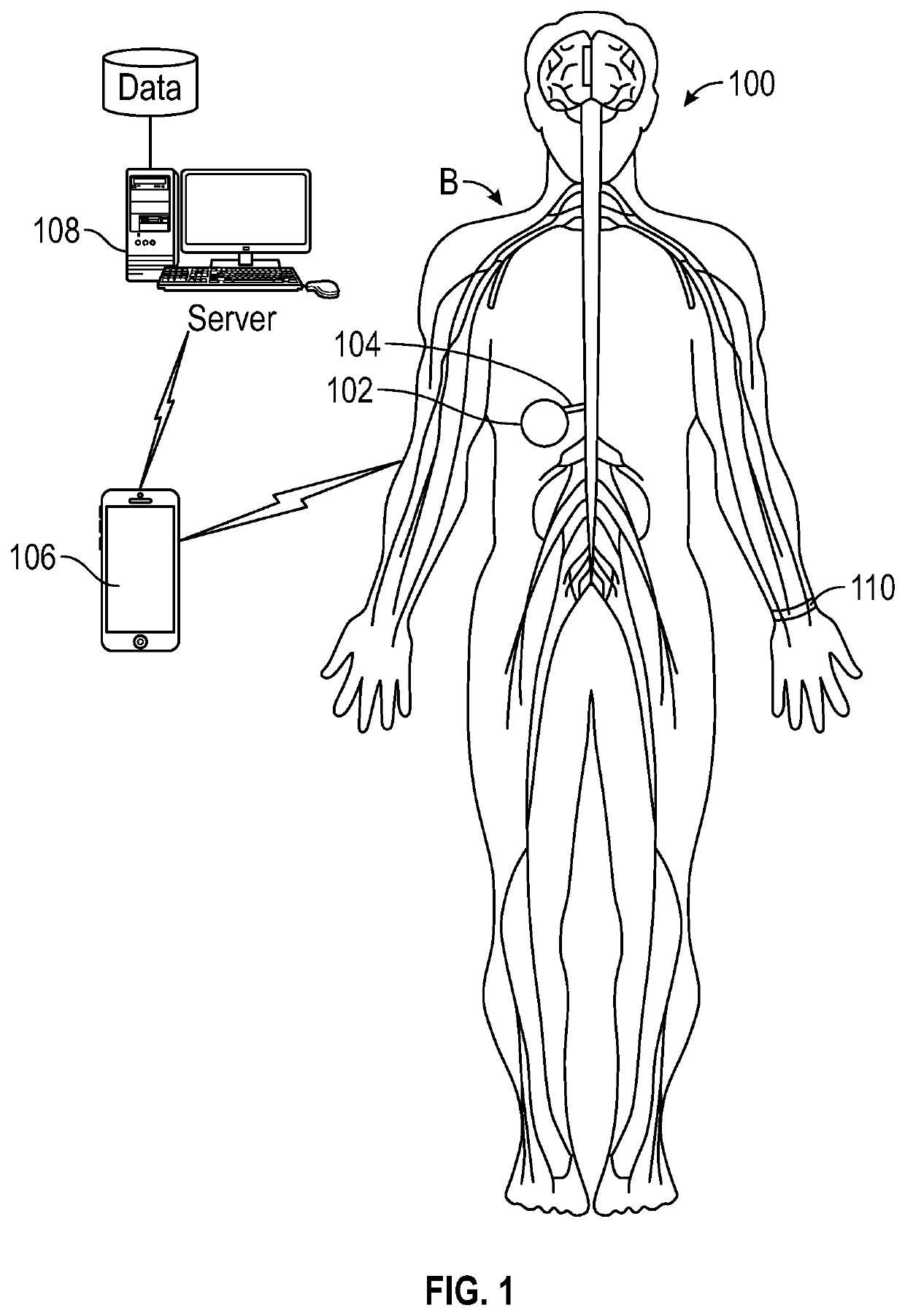 Method to detect inadvertent delivery of drug to a subcutaneous pocket