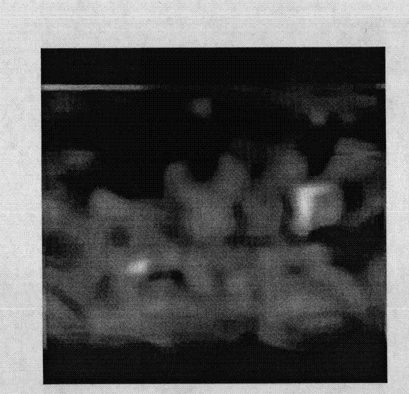 Enhancement method aiming at passive millimeter wave image