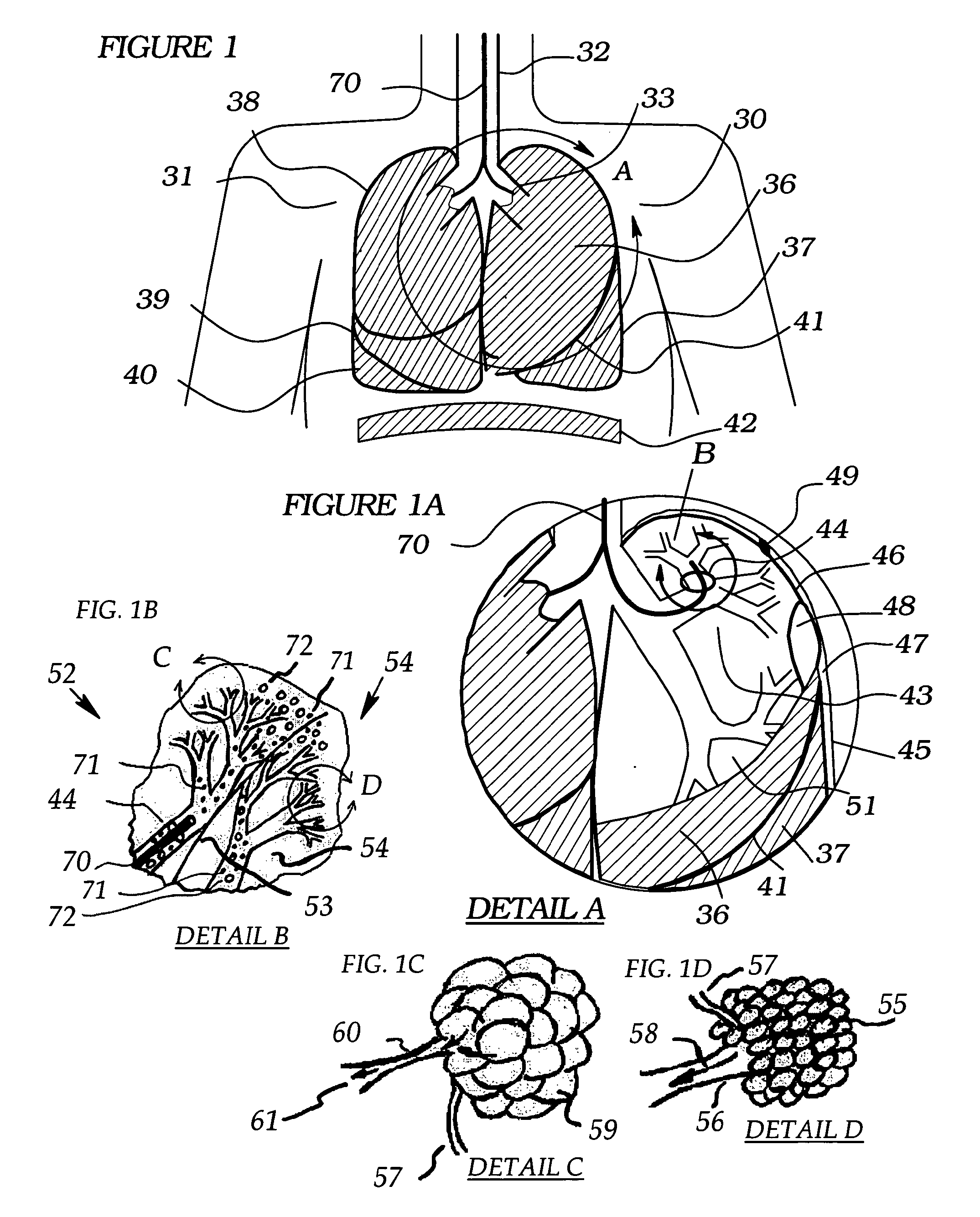 Methods, systems and devices for desufflating a lung area