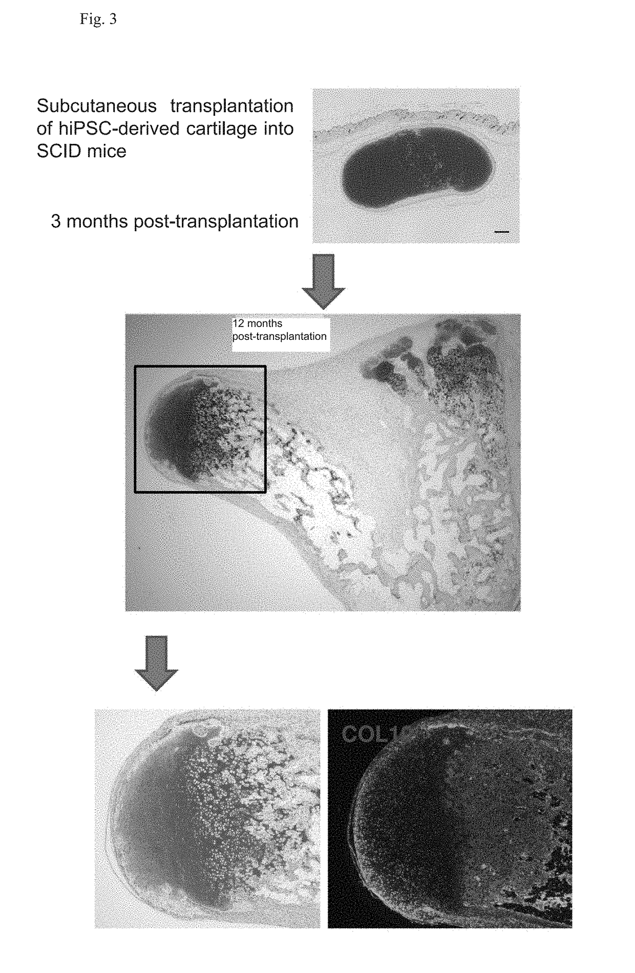 Novel method for chondrogenic induction