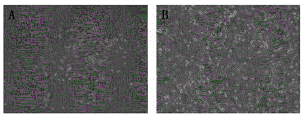 Endothelial progenitor cell (EPC) culture method