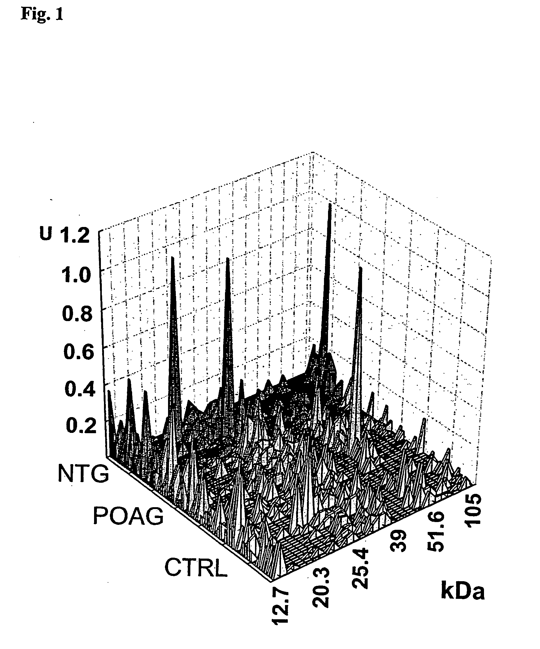 Diagnosis of glaucoma by complex autoantibody repertoires in body fluids