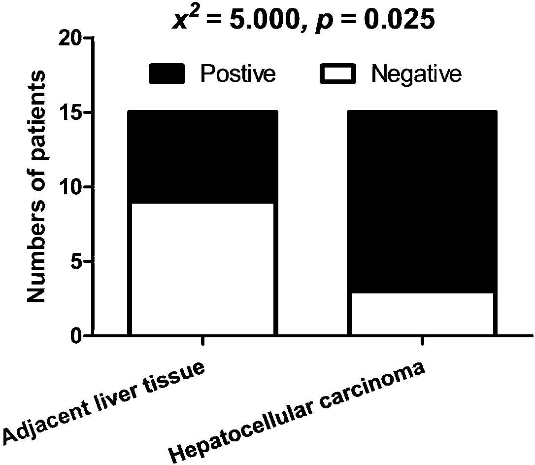 Hepatocellular carcinoma auxiliary diagnosis or disease surveillance kit and application thereof