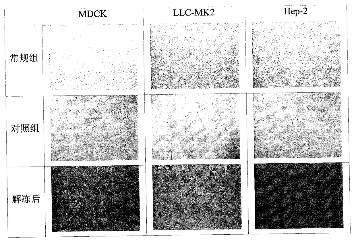 Anchorage-dependent cell cryoprotectant, cryopreservation method and thawing method