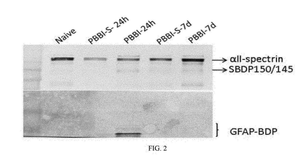 Micro-rna, autoantibody and protein markers for diagnosis of neuronal injury