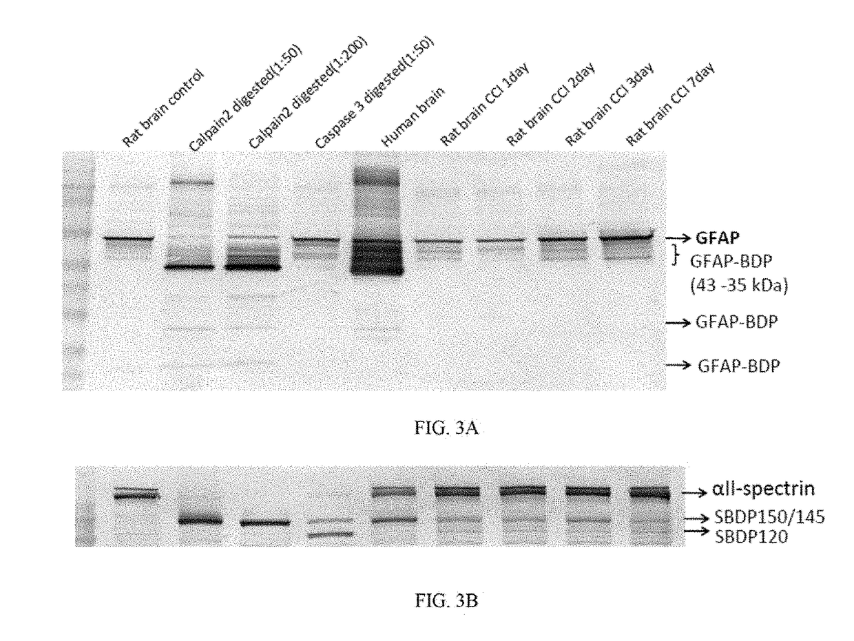 Micro-rna, autoantibody and protein markers for diagnosis of neuronal injury