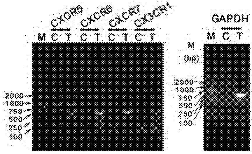 Method for inhibiting lymphangiogenesis by administration of an inhibitor of the cxcl12 pathway