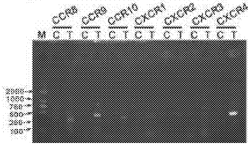 Method for inhibiting lymphangiogenesis by administration of an inhibitor of the cxcl12 pathway