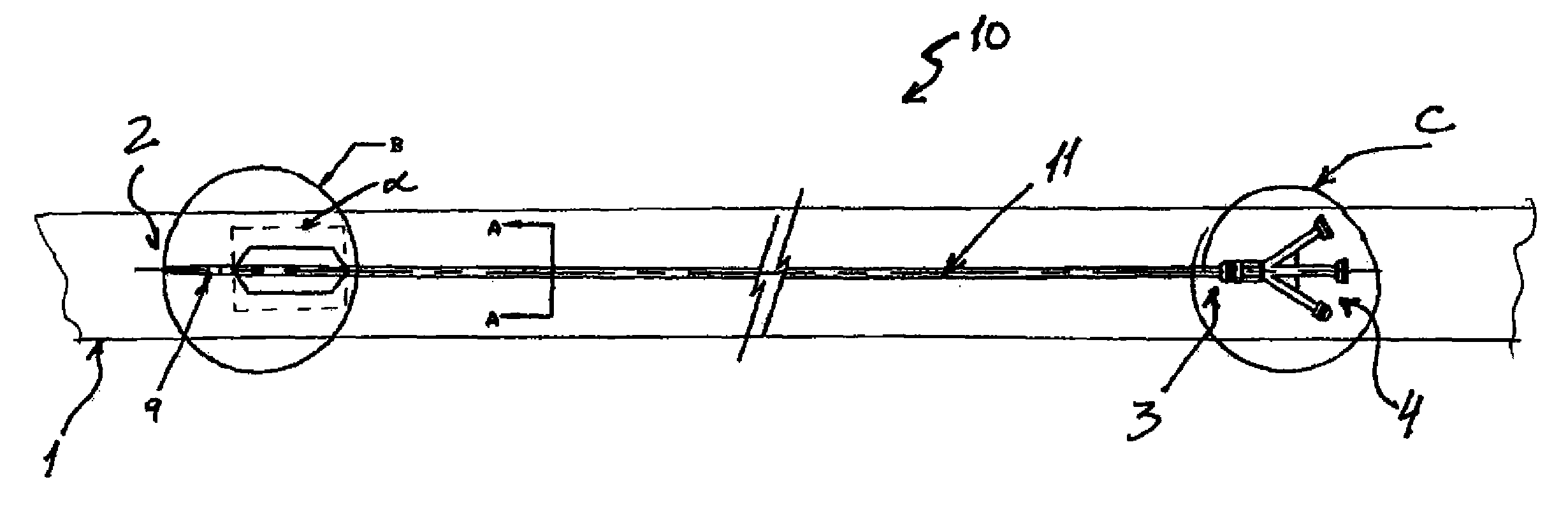 Percutaneously retrievable stent assembly with fluid draining capability