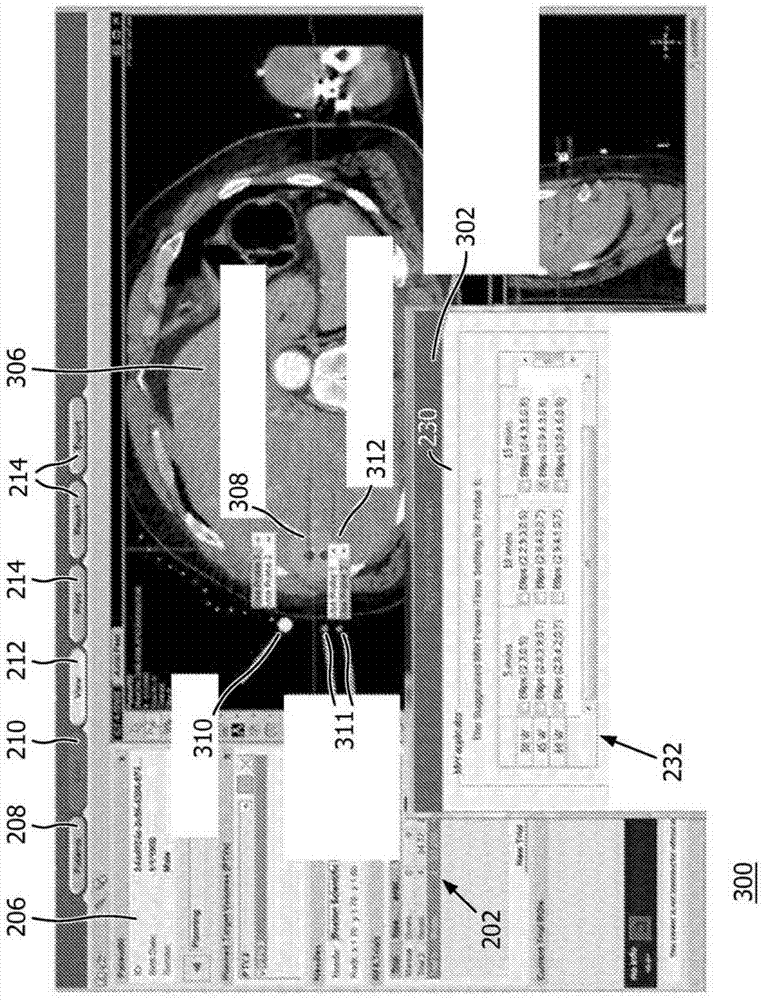 Ablation Planning System