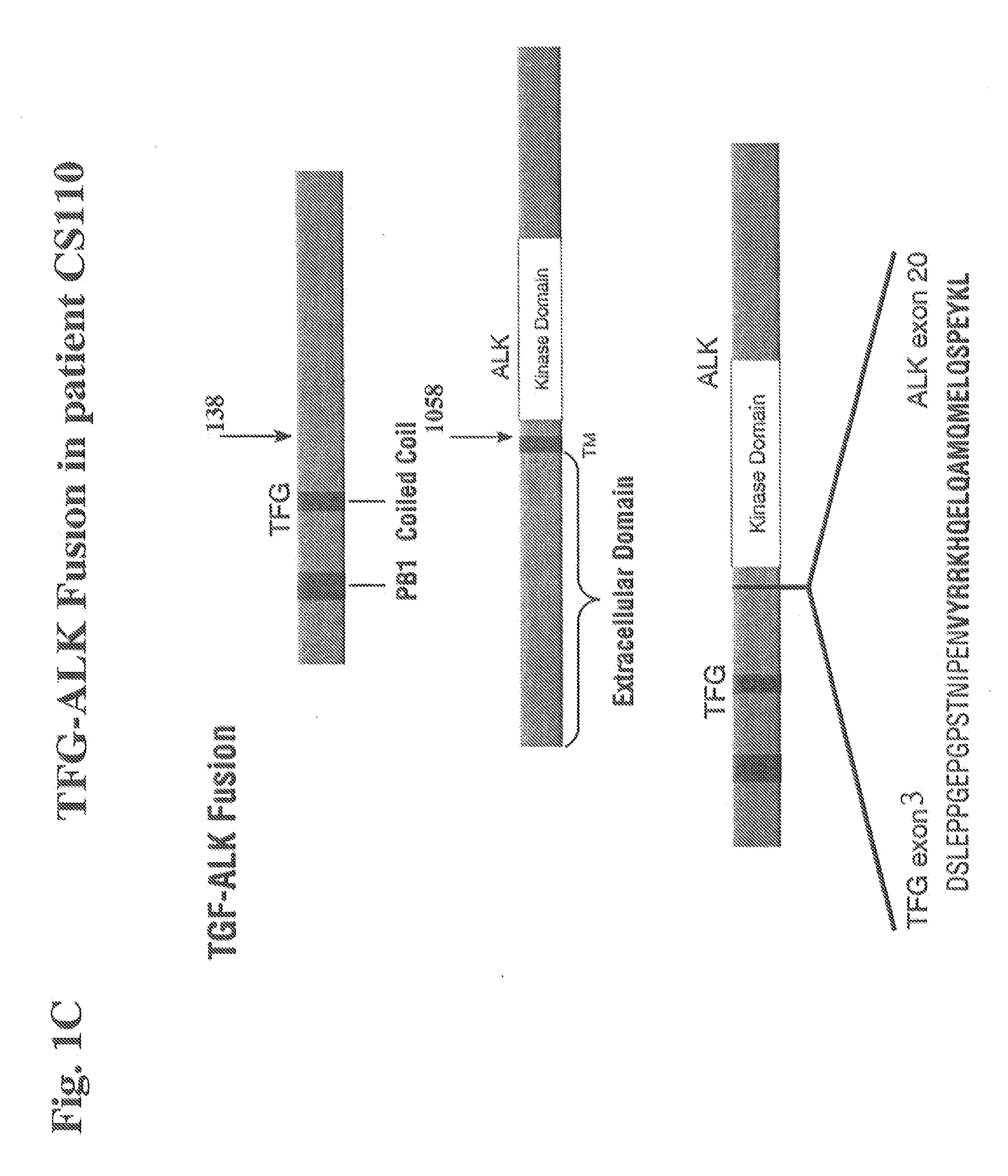 Gene Defects And Mutant ALK Kinase In Human Solid Tumors