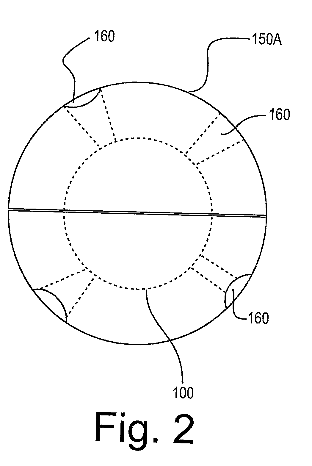 Anomaly Detector for Pipelines