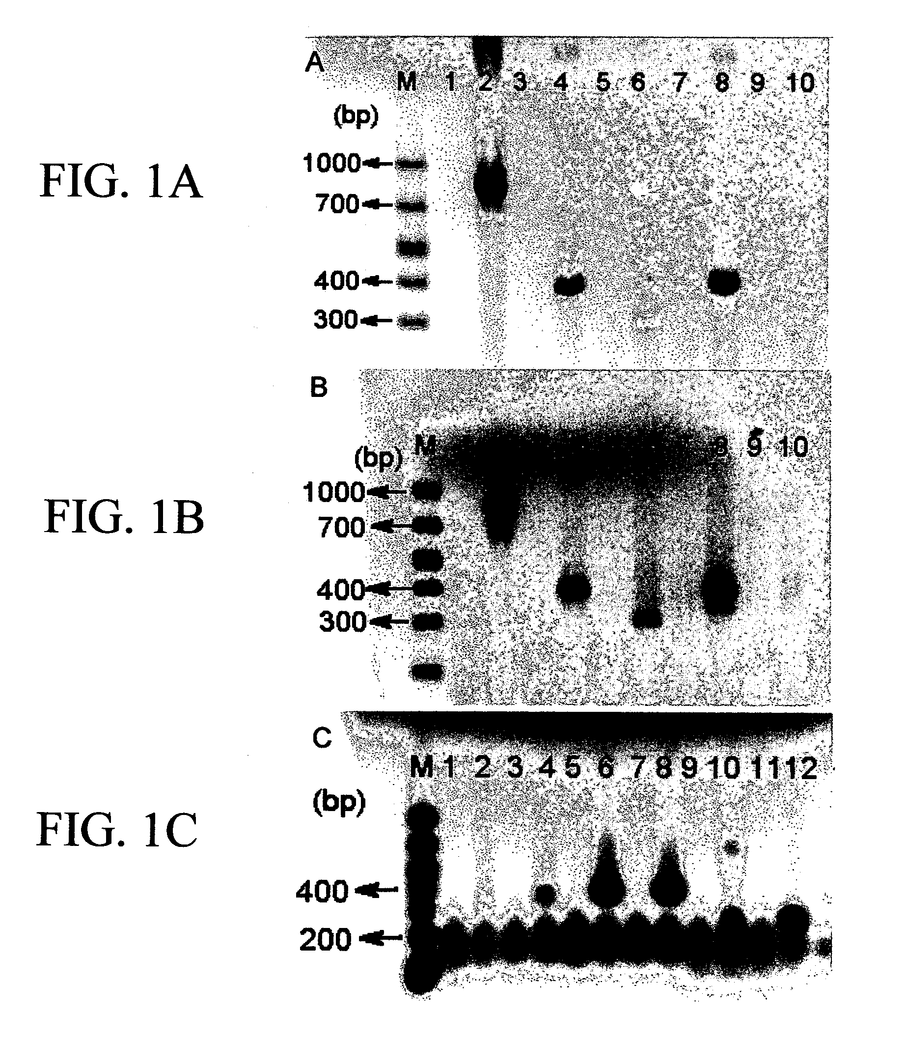 Human cord blood as a source of neural tissue for repair of the brain and spinal cord