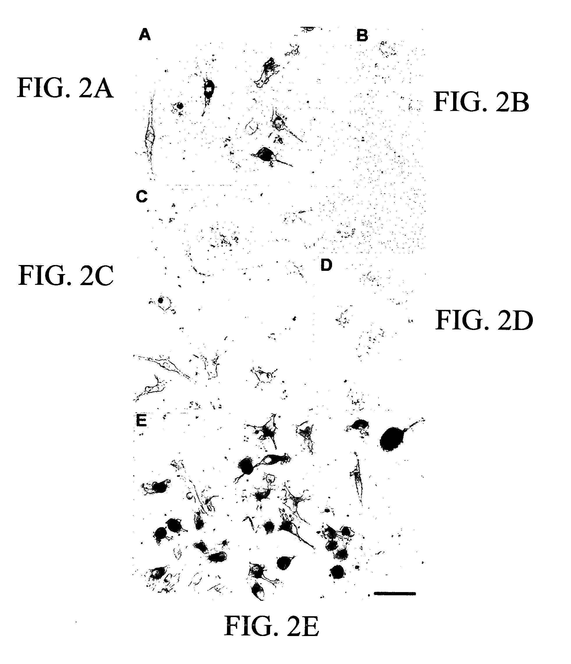 Human cord blood as a source of neural tissue for repair of the brain and spinal cord