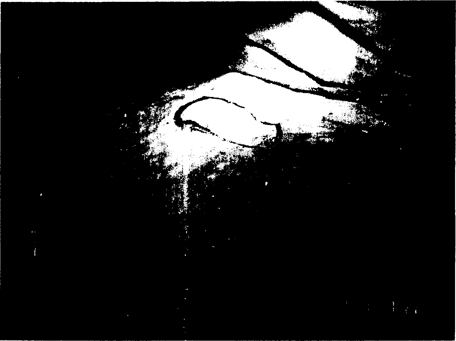 Tissue engineering autologous complex skin and its preparation method