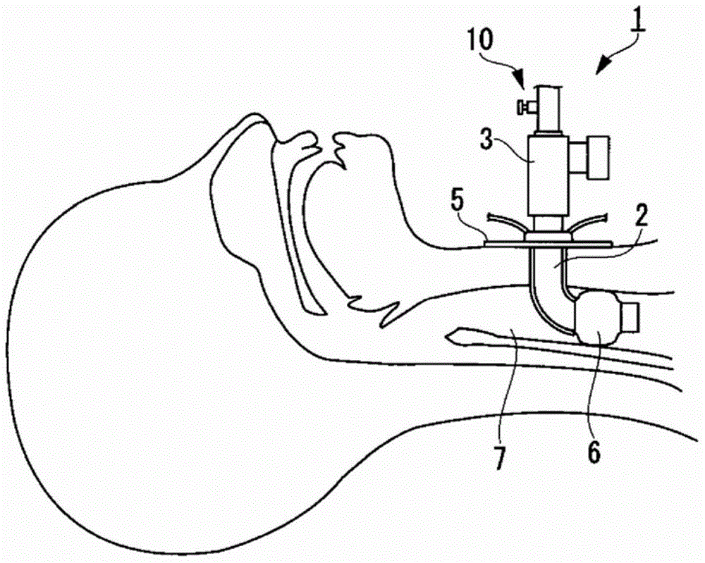 Suction connector and tracheal tube